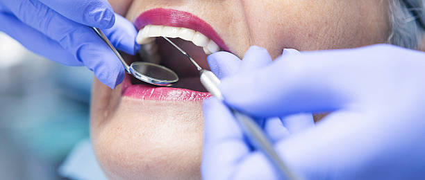 Best Emergency Tooth Extraction in Inez, TX